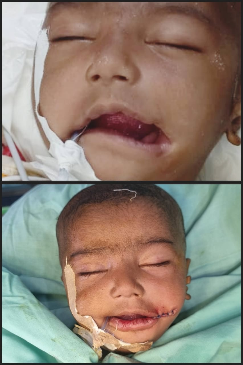 Before & After 20